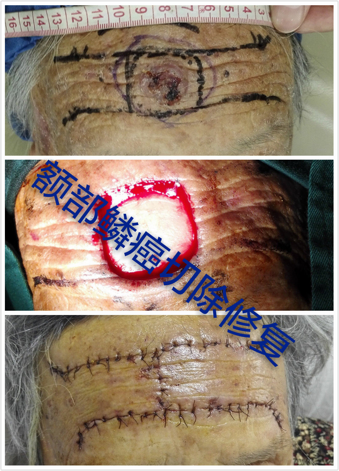 ���״ϸ����