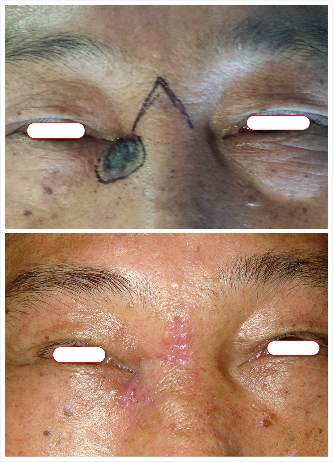 ��������ϸ����