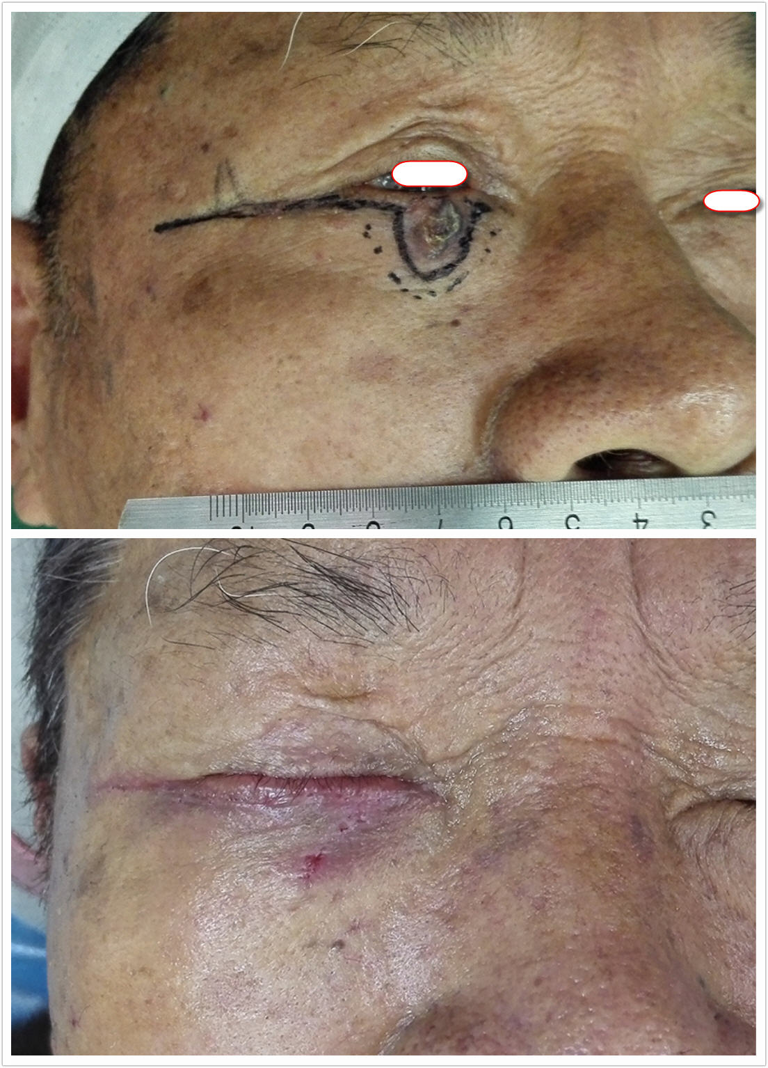 ��������ϸ����