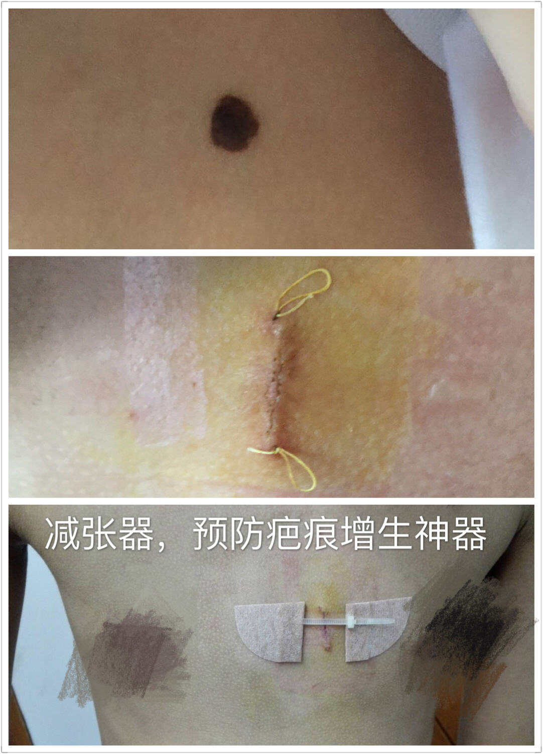 ��ͯ�ز�����