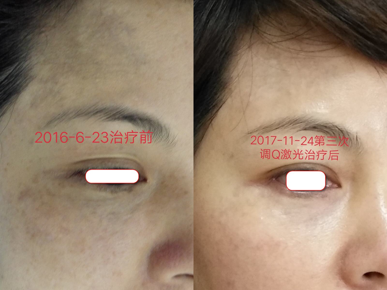 ��Q755����̫����